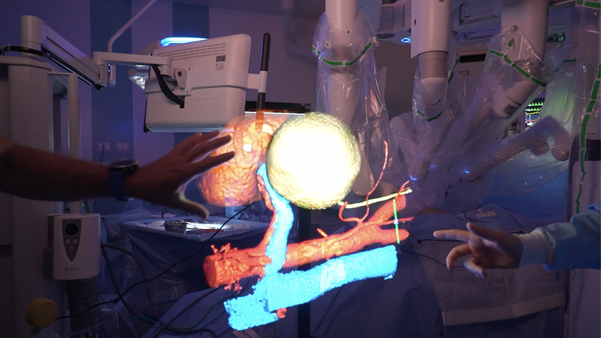 RAISE e la ricostruzione 3D degli organi: un progetto di Spoke 2 con l’Ospedale San Martino di Genova